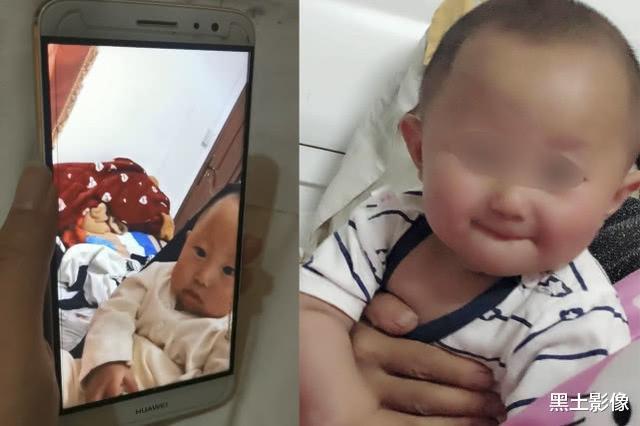 美女为生娃导致面部畸形,流浪街头自救:想活久一点,陪儿子长大