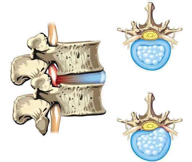 为何你那么突出,为什么你如此突出