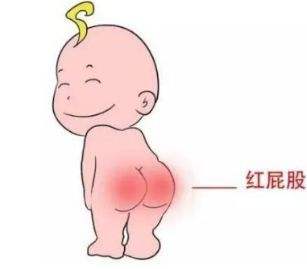 敏感肌高端纸尿裤,夏天敏感肌宝宝专用纸尿裤