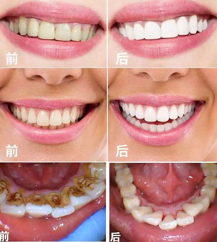 电动牙刷一般怎么充电 (电动牙刷一般怎么充电的)