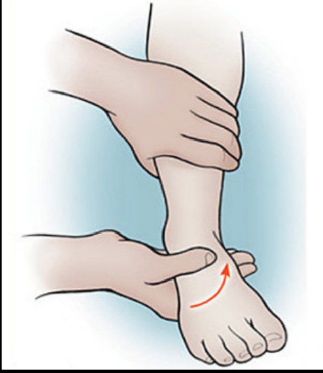 足踝扭伤疼痛位置图,踝足扭伤机制