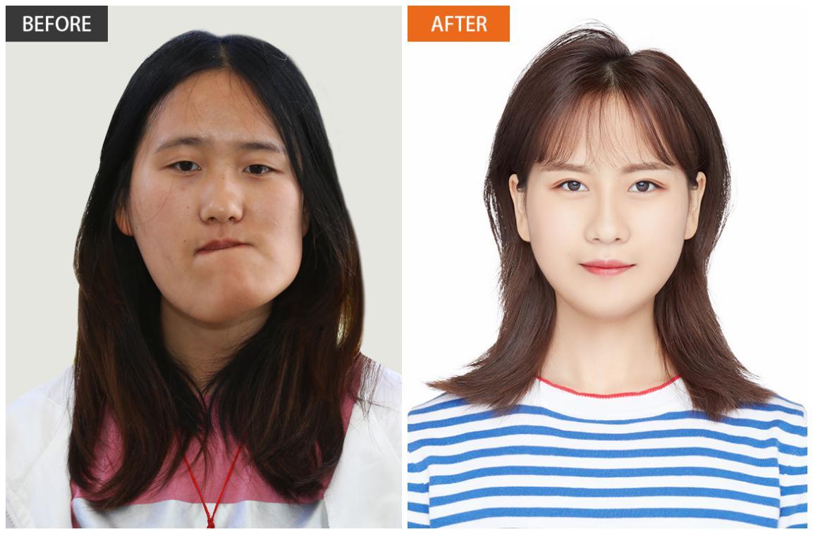 “歪脸女孩”赵宏秋，不当网红当老师，网友：这才是整形的真谛