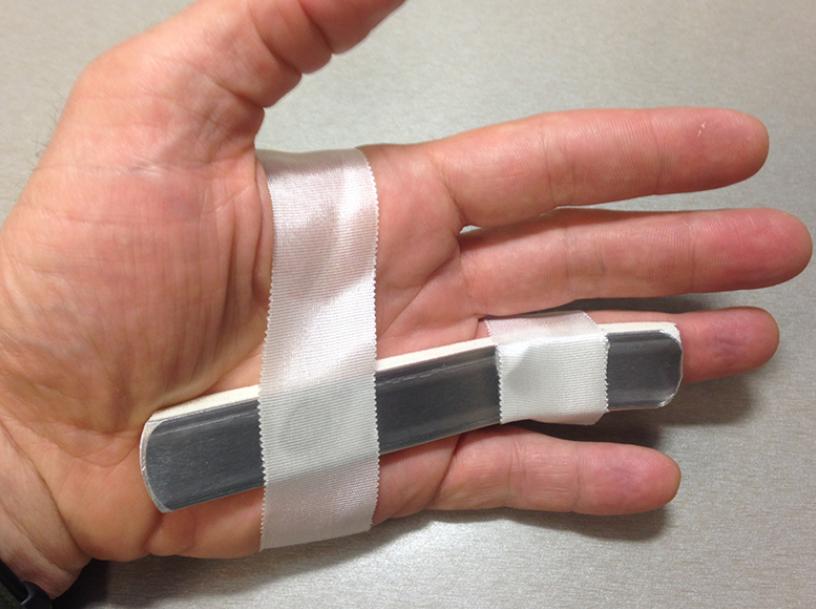 路医生说丨常做家务、常敲键盘玩手机人容易得扳机制，该怎么治？