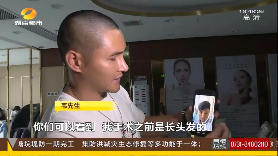 长沙29岁小伙接受5项整形，术后头皮坏死致大面积脱发！《民法典》侵权责任编：须告知医疗风险并征得同意