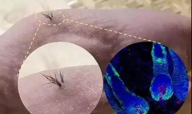 干细胞疗法神奇的干细胞再生医学,干细胞能使神经再生吗