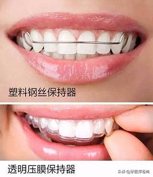 门牙拥挤不齐最快矫正方法,牙齿拥挤引起的不齐好不好矫正