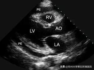 ct胶片的种类,ct胶片有利用价值吗