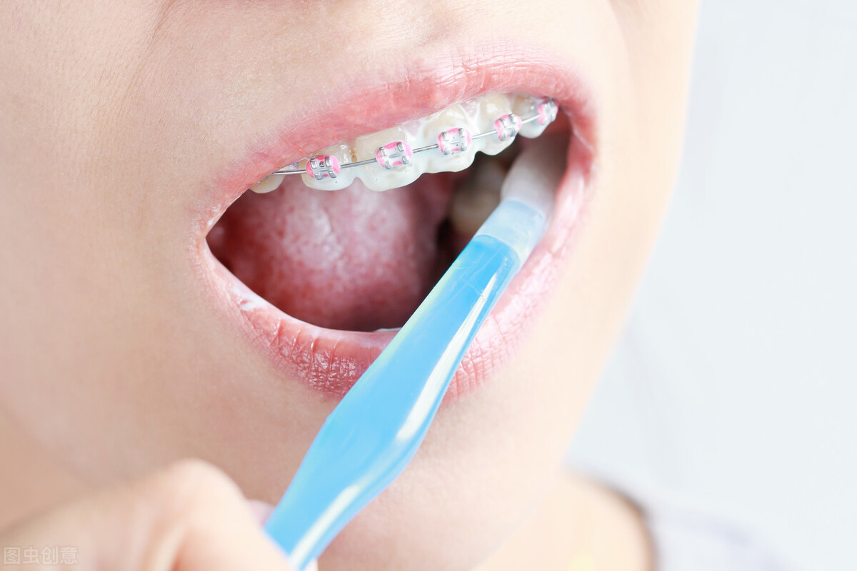 初期蛀牙护理,牙齿蛀牙初期