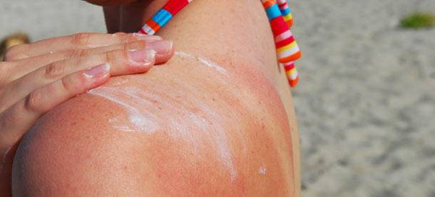 晒后晒伤发红修复最有效的办法,晒后修护可以涂抹晒伤的皮肤吗