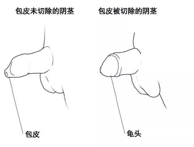 男宝包皮过长什么时候治疗,初到人间的宝宝
