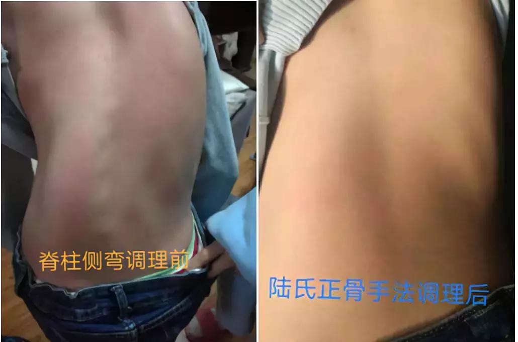 陆氏九龙正骨全套完整视频,陆氏正骨