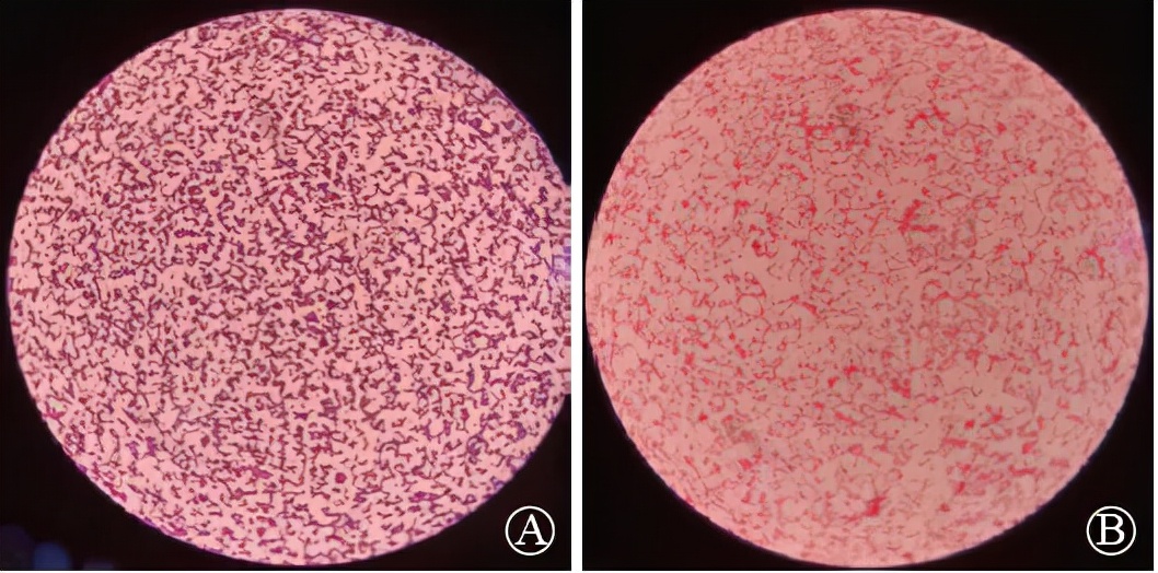 手术切口感染的主要病原菌是 (骨科一类切口感染原因分析)