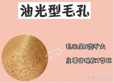 毛孔粗大到底怎么有效解决,毛孔粗大有哪几种类型