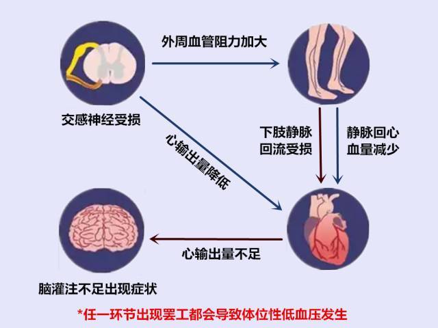老年人低血压的最佳治疗方法,老年人低血压最快补救方法