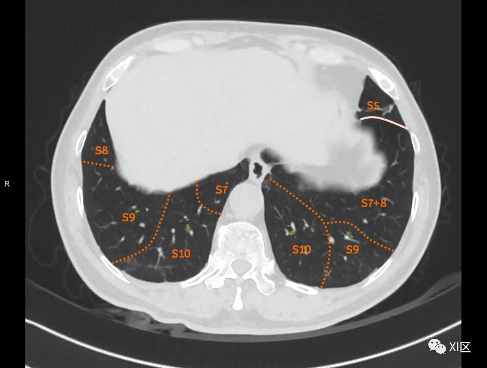 如此详细的肺部影像解剖，有点儿酷！