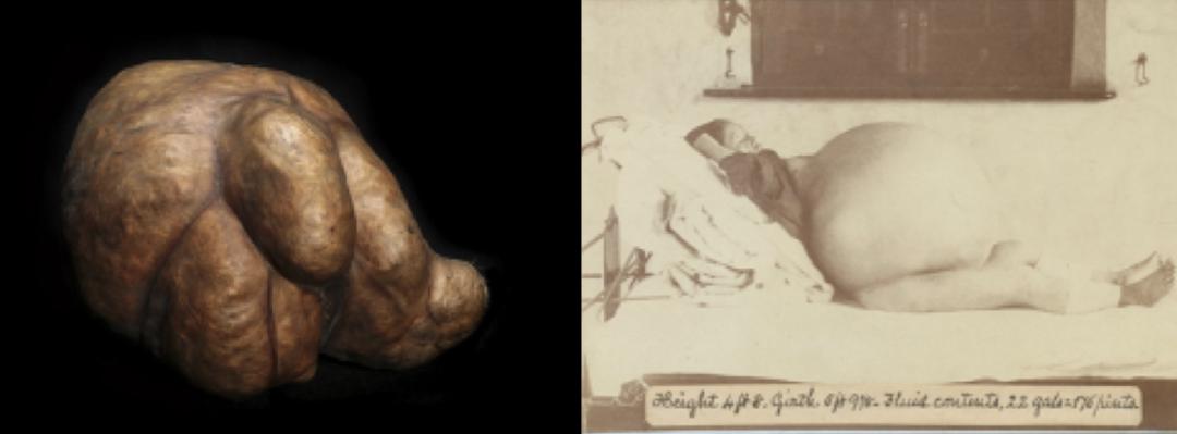 爱因斯坦的大脑解剖全过程,爱因斯坦的大脑为科学奉献一生