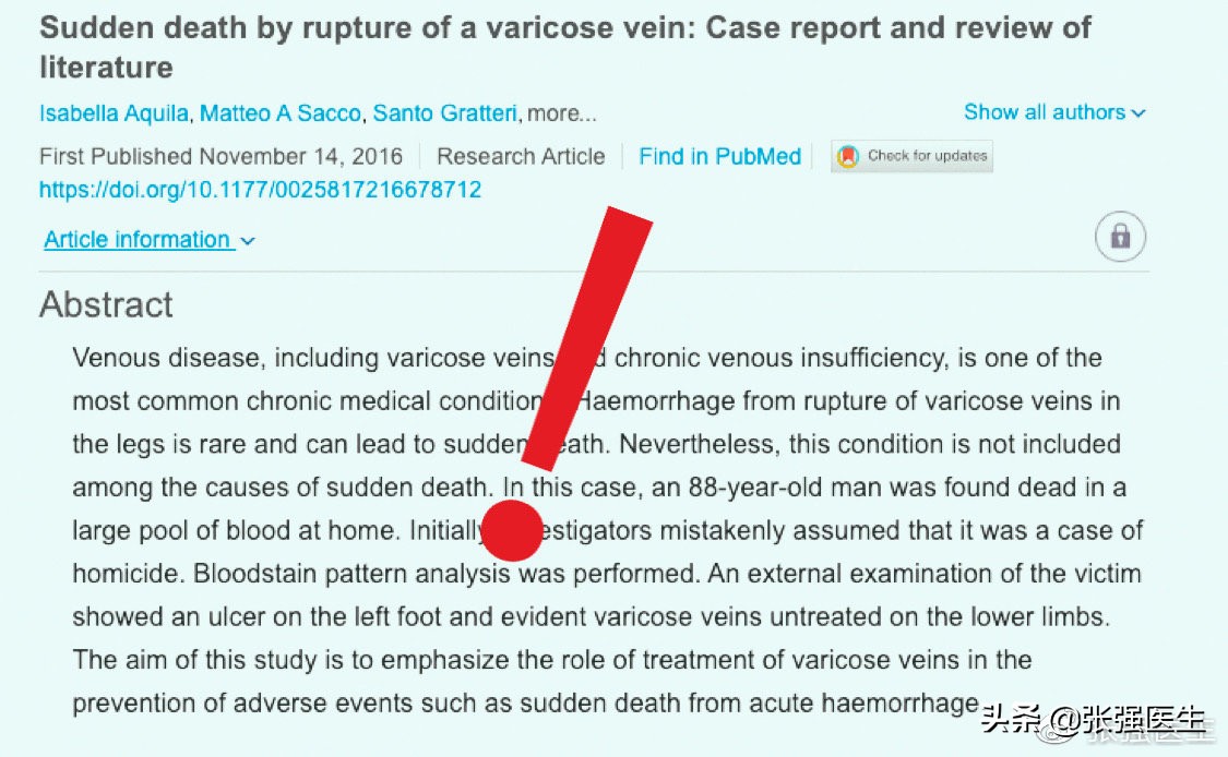 高龄老人静脉曲张破裂怎么办？