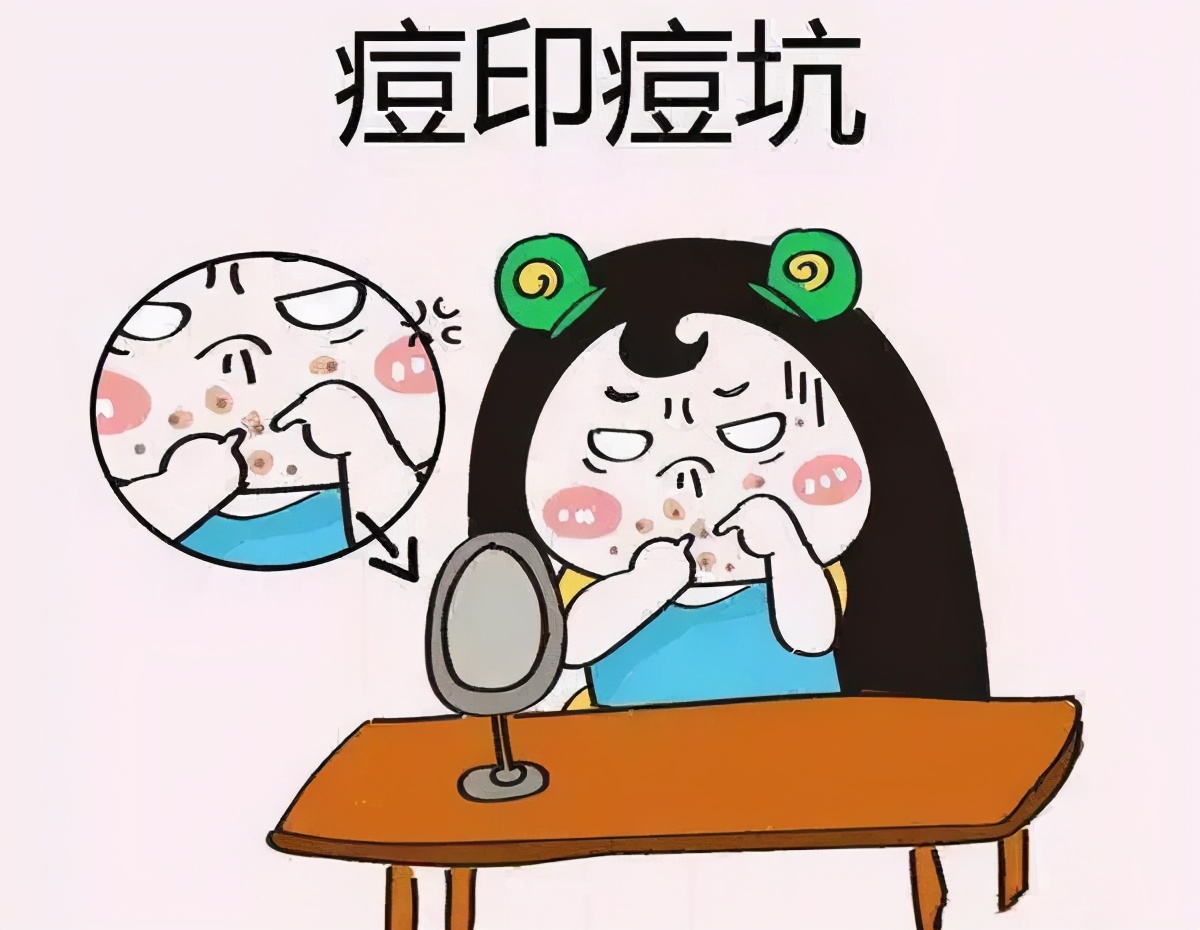 做完光子去痘印四天痘印红,激光祛痘印和光子祛痘印哪个好