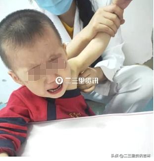 婴儿出生时臂丛神经被医生拉断,婴儿出生时手臂被医生拉断了