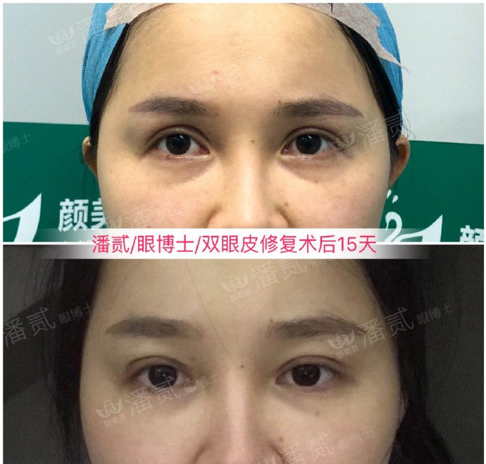 双眼皮凹陷眉毛怎么设计好看,凹眼窝适合什么眉型