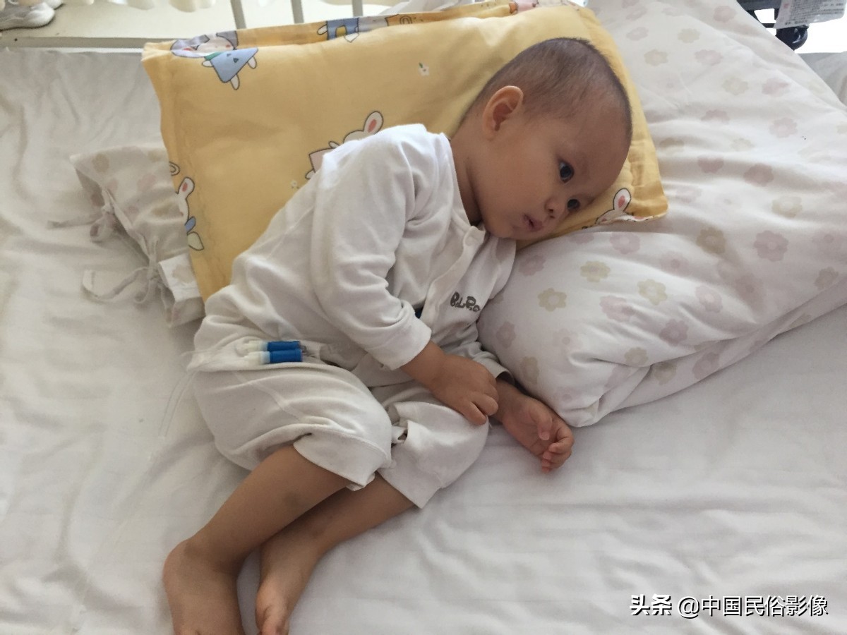 小朋友长牙齿发低烧,长牙引起的低烧一般要几天