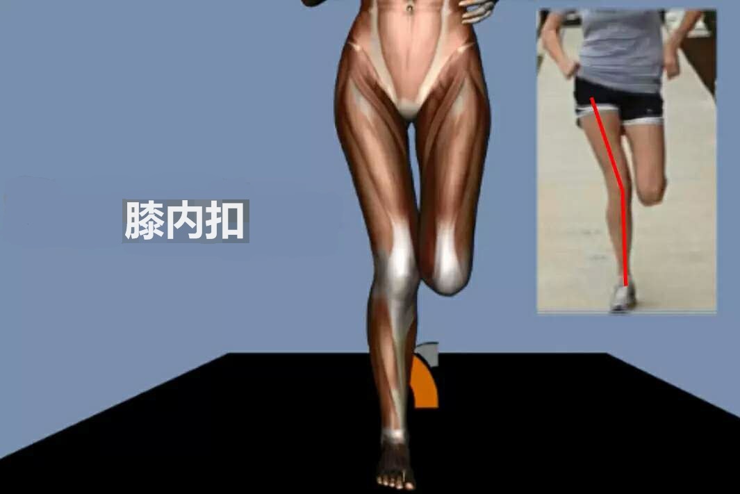 跑步对膝盖的正确训练,错误跑步姿势小腿疼怎么办