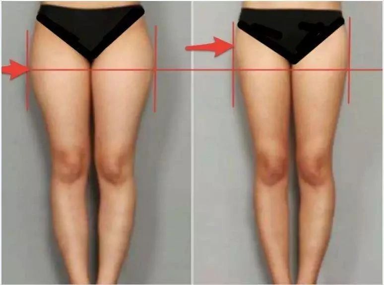 站立臀部凹陷假胯宽最有效的锻炼,避免臀凹陷和假胯宽的正确坐姿