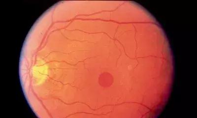 眼前一直有蚊子是什么病,眼前总有蚊子飞怎么治呀