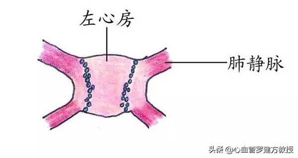 发生心律不齐，怎么样才能恢复正常？#原创首发##青云计划#