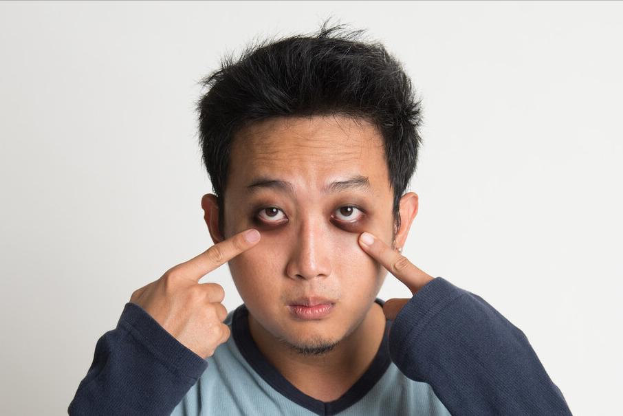 治疗黑眼圈最有效的产品,prp治疗黑眼圈需要做几次费用多少