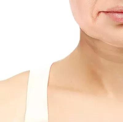 目前去颈纹比较好的方法,去颈纹有没有什么好的产品