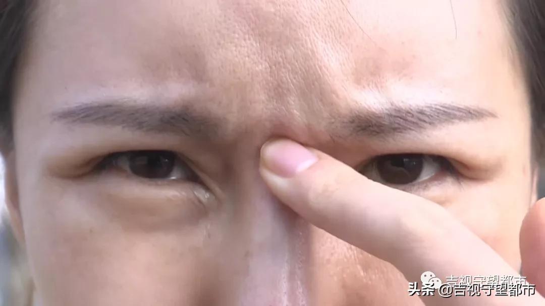 鼻综合三万块钱贵吗,一万块可以做鼻综合吗