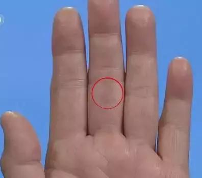 手上7个小细节竟然暗藏大健康,手诊10种常见病从手上就能看出来