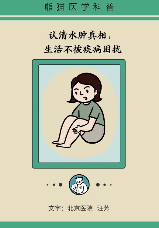 女性经期小腿以下水肿怎么办,起床肿怎么办
