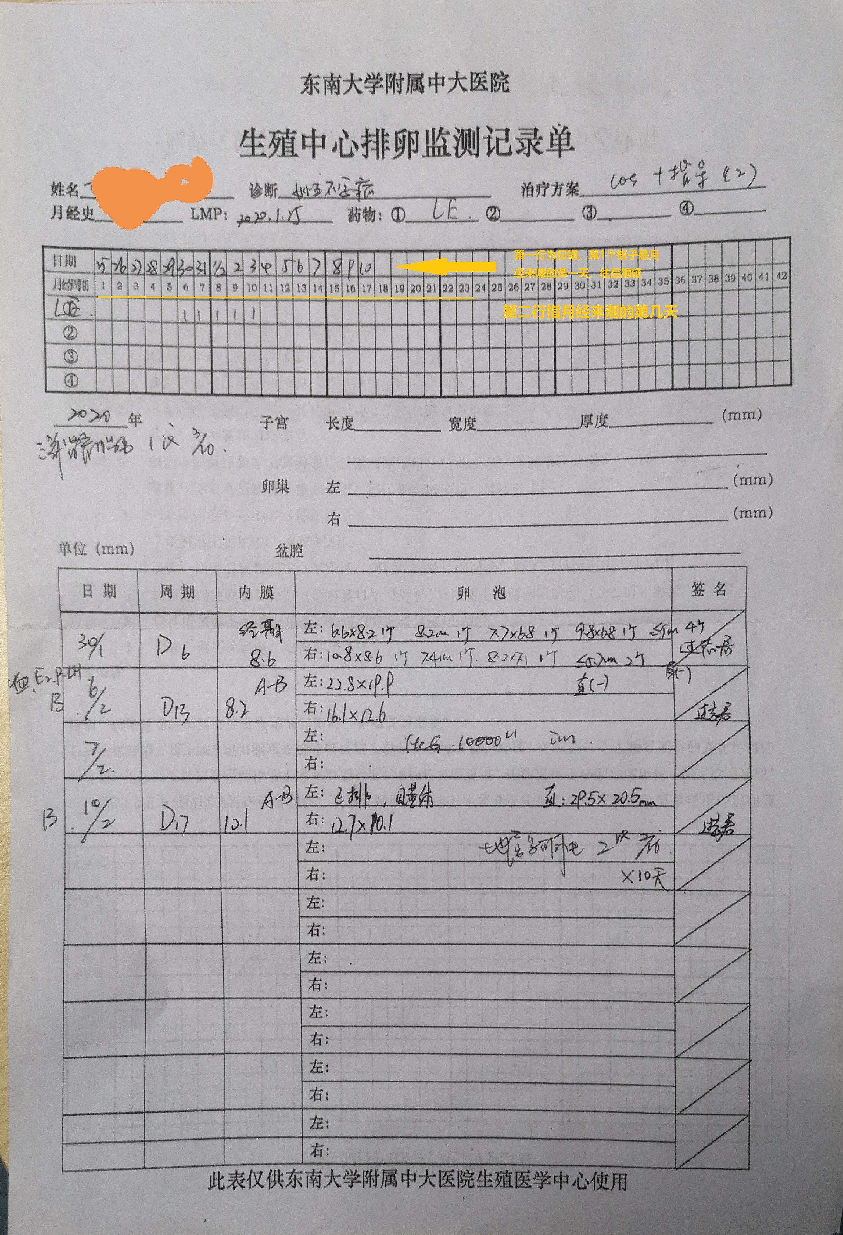 排卵障碍性不孕症的诊疗策略,排卵障碍不孕中最常见的原因是