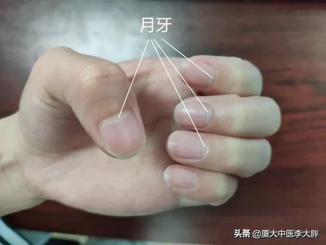 激情过后总是尿频、腰酸,这到底是不是肾虚,该怎么调理?