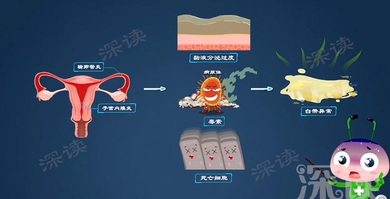没有白带下腹痛会是附件炎吗,小腹胀痛有白带有妇科炎症吗