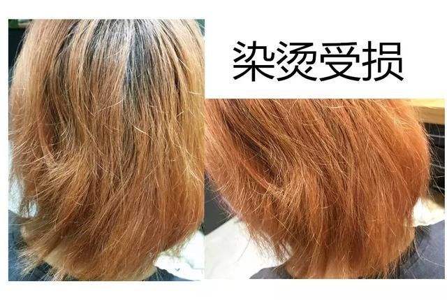 掉发严重是哪些疾病会引起,掉发太严重了需要补充什么