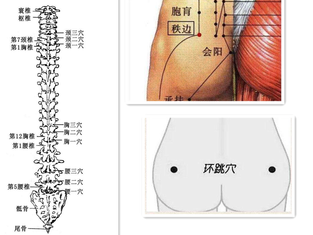 坐骨神经痛起不了床怎么办呢,坐骨神经痛怎么治疗有哪些偏方