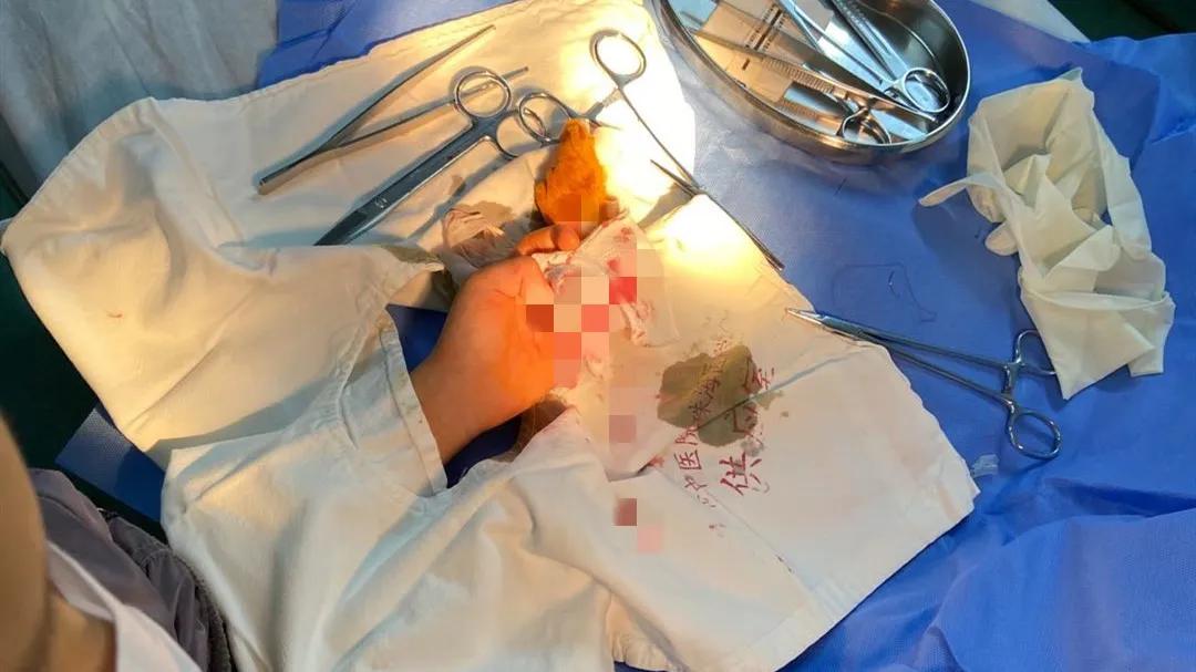 小男孩切东西不小心切到自己的手,儿子切水果时不小心割到手指