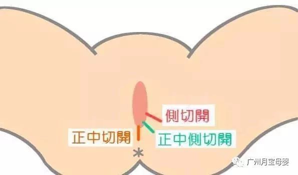 屁股大的女生好生养,屁股大的女人适合生孩子吗