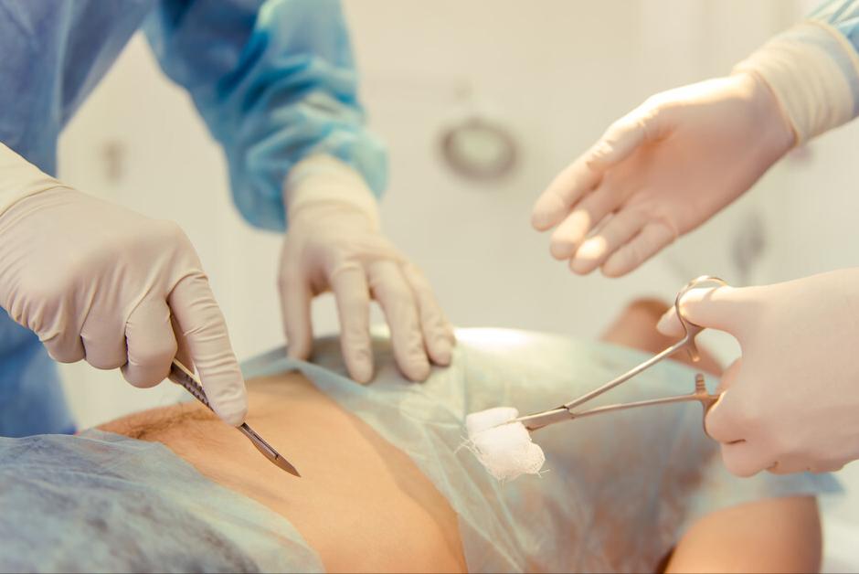 儿童急性阑尾炎的初期症状,急性阑尾炎中医治疗及预防方法