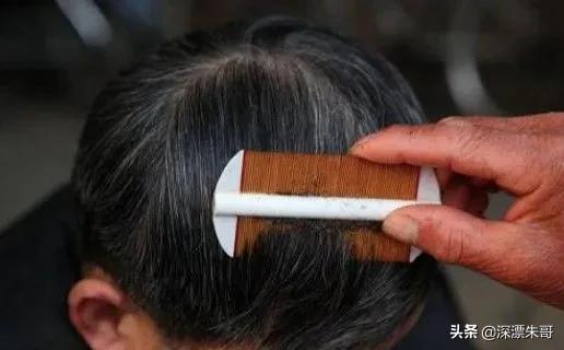 三十年前的虱子为什么消失了,8090年代的虱子是怎么灭绝的