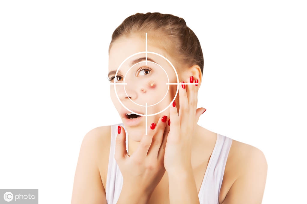 真正能祛痘的产品评测,有没有一款真正的祛痘的产品