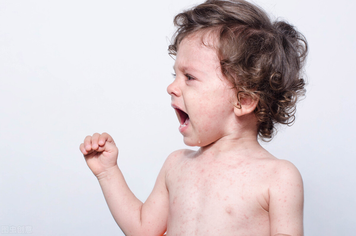 说说新生儿长痱子的预防和护理,夏天天气热用什么预防宝宝长痱子