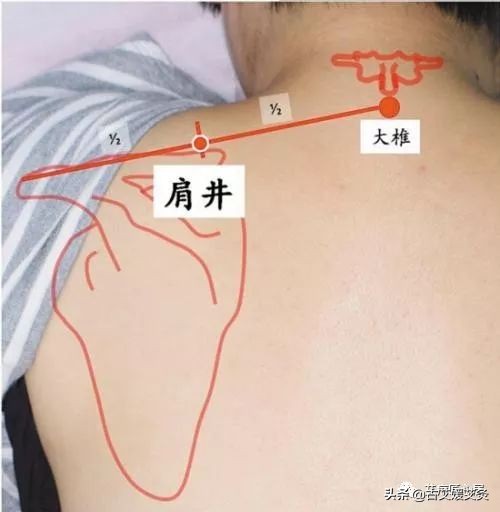 肩胛骨有结节一定有乳腺增生吗,肩胛缝有结节乳腺就有结节吗