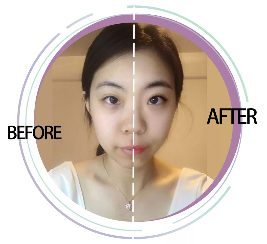 求改善痘痘真实办法,想改变脸上痘痘