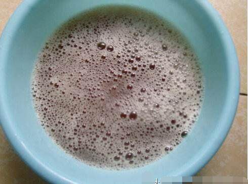 头皮银屑病建议多久洗一次头,头屑严重中医怎么处理