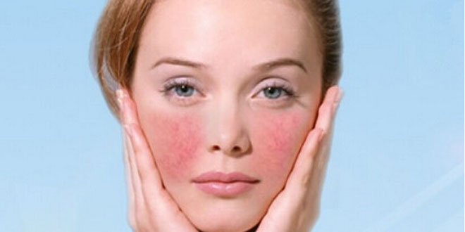 化妆品过敏反应的应急预案,化妆品过敏最好最快的解决方法