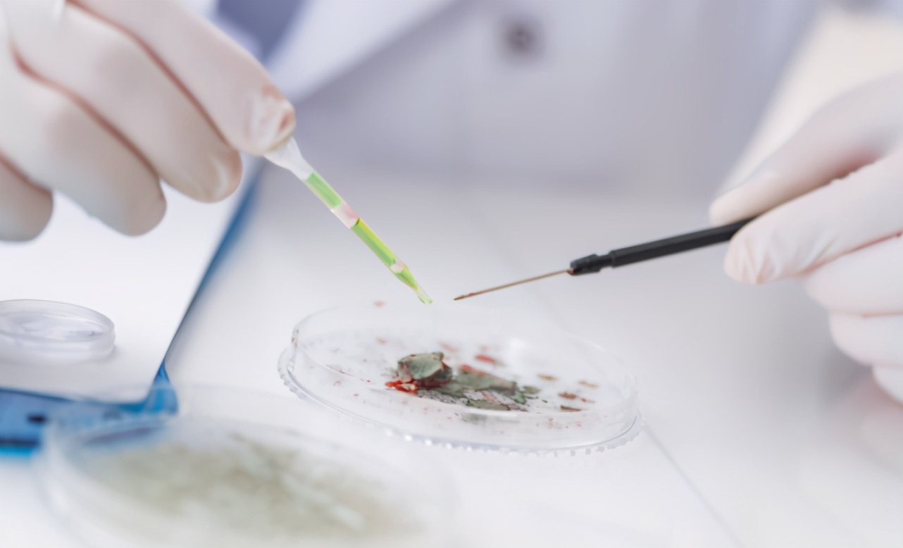 广药三院肿瘤二科|27岁女孩,查出宫颈癌,连续交往多个男友